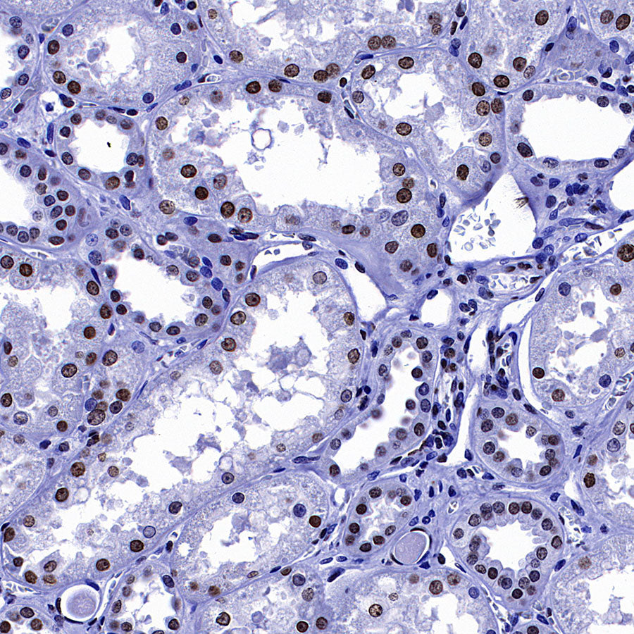 Histone H3 Recombinant Rabbit mAb (S-5672)