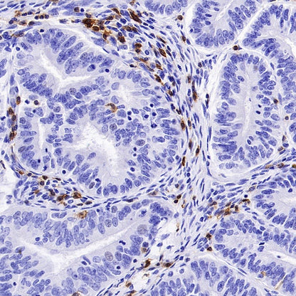 CD5 Recombinant Rabbit mAb (SDT-2570-53)