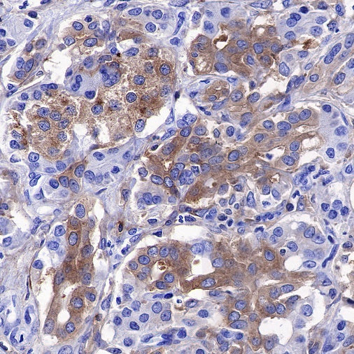 PKC alpha Recombinant Rabbit mAb (S-624-36)