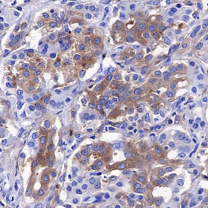 PKC alpha Recombinant Rabbit mAb (S-624-36)