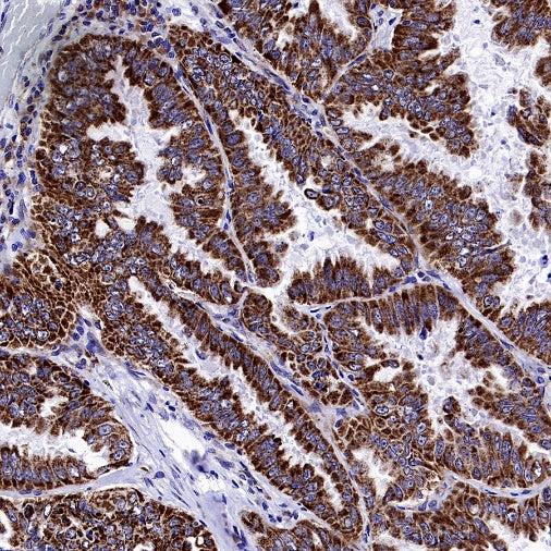 GPD2 Recombinant Rabbit mAb (S-2941-41)