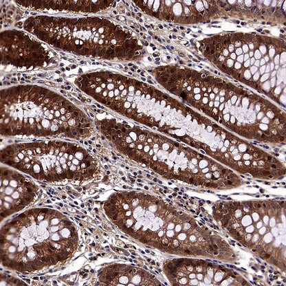 4E-BP1 Recombinant Rabbit mAb (S-4103-65)