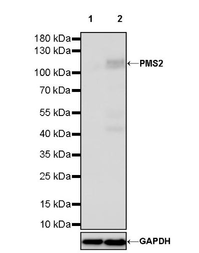 S-RMab® PMS2 Recombinant Rabbit mAb (SDT-R460)