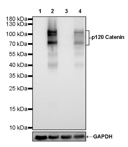 p120 Catenin Recombinant Rabbit mAb (SDT-350-75)