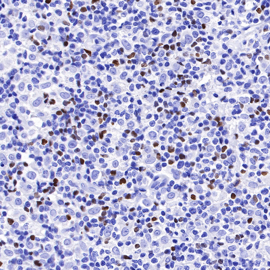 S-RMab® FOXP3 Recombinant Mouse mAb,PBS Only (SDT-R149)