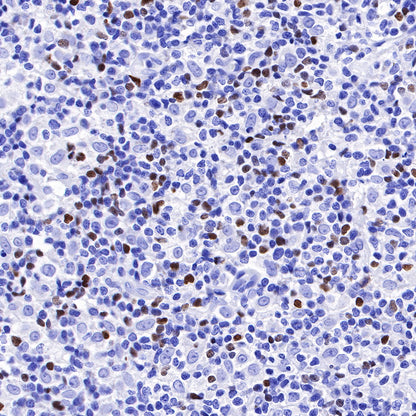 S-RMab® FOXP3 Recombinant Mouse mAb,PBS Only (SDT-R149)