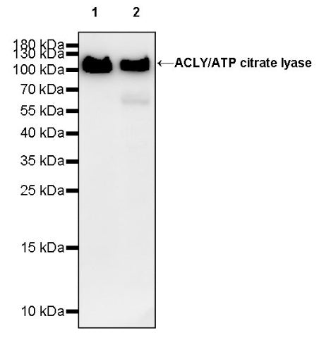ACLY/ATP citrate lyase Recombinant Rabbit mAb (S-2025-32)