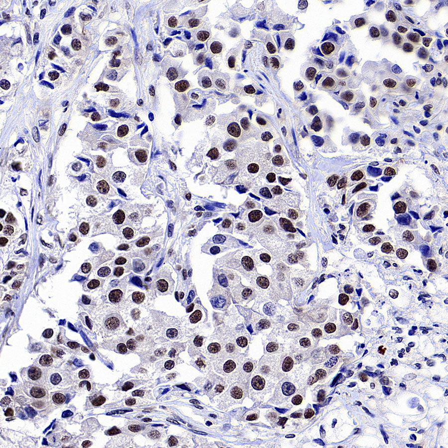 PTBP1 Rabbit Polyclonal Antibody