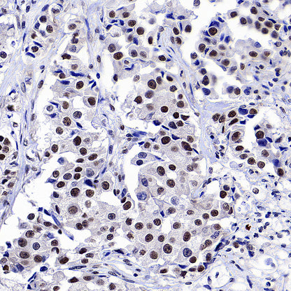 PTBP1 Rabbit Polyclonal Antibody