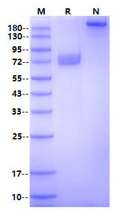 Biotinylated IL-21R Fc&Avi Tag Protein, Human
