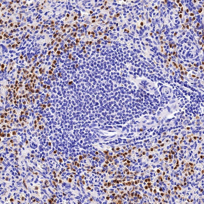 CXCR2 Recombinant Rabbit mAb (S-1292-30)
