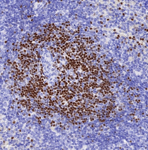 LEF1 Recombinant Rabbit mAb (S-500-34)