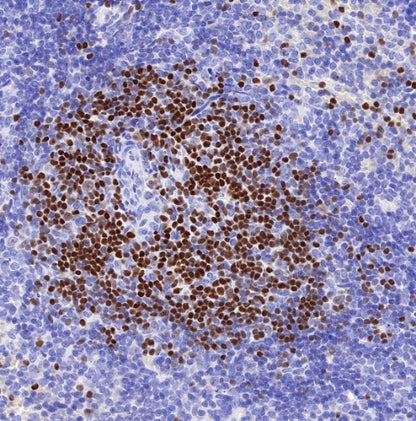 LEF1 Recombinant Rabbit mAb (S-500-34)
