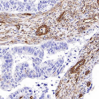PTRF Recombinant Rabbit mAb (S-3271-13)