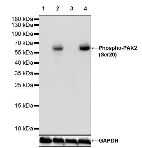 Phospho-PAK2 (Ser20) Recombinant Rabbit mAb (S-507-231)