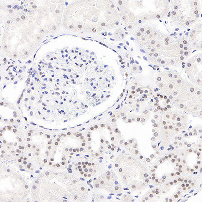 Anti-5-methylcytosine (5-mC) Recombinant Mouse mAb (S-3720)