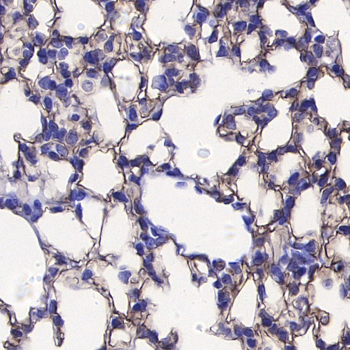 Podoplanin Recombinant Rat mAb (S-3419)