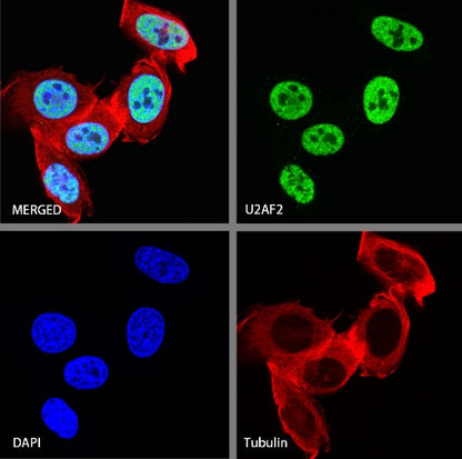 U2AF2 Recombinant Rabbit mAb (S-1324-66)