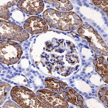 Aquaporin 1/AQP1 Recombinant Rabbit mAb (S-794-79)