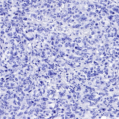 FGFR2b Recombinant Rabbit mAb (SDT-423-18)