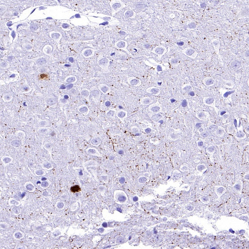 Calretinin Recombinant Rabbit mAb (SDT-2773-21)