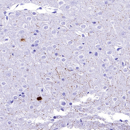 Calretinin Recombinant Rabbit mAb (SDT-2773-21)