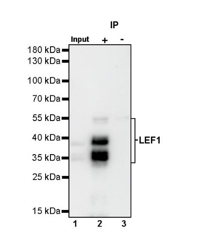LEF1 Recombinant Rabbit mAb (S-500-34)
