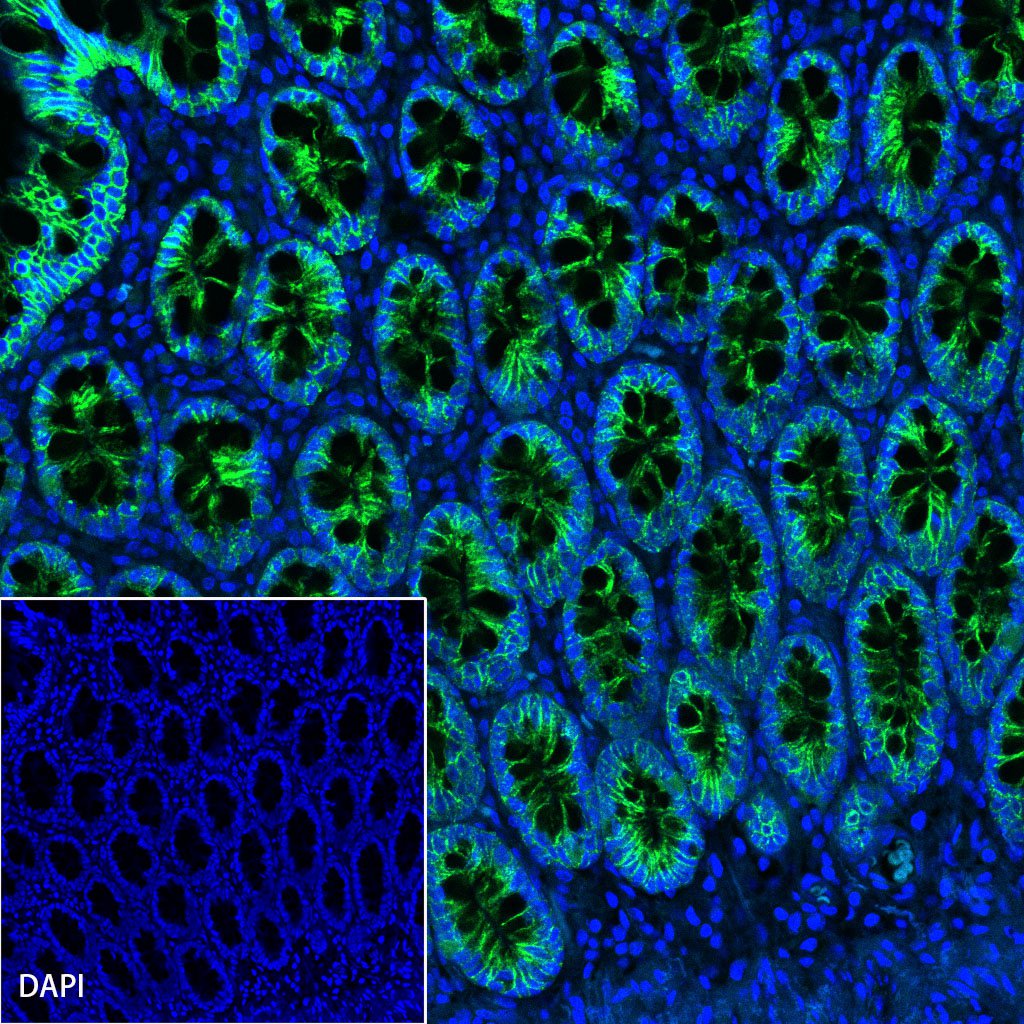 Cadherin 17 Recombinant Rabbit mAb,PBS Only (SDT-R151)
