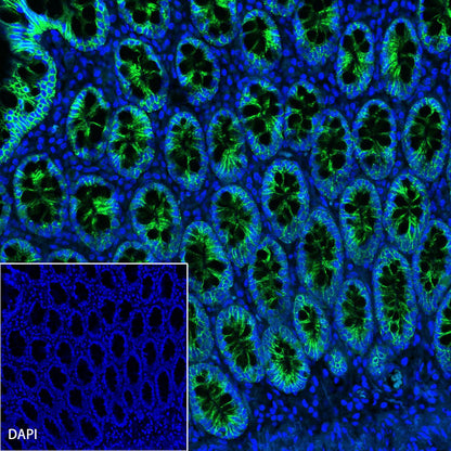 Cadherin 17 Recombinant Rabbit mAb,PBS Only (SDT-R151)
