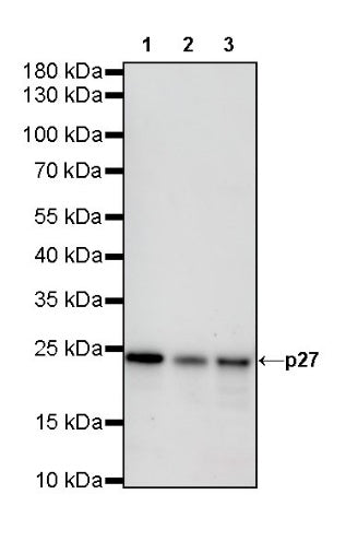 p27 Recombinant Rabbit mAb (S-141-135)