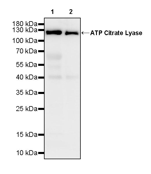 ATP Citrate Lyase Recombinant Rabbit mAb (S-5036)