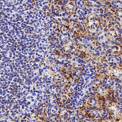 COX1/Cyclooxygenase 1 Recombinant Rabbit mAb (S-1478-48)
