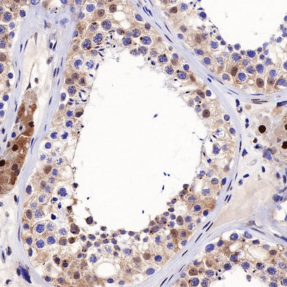 SQSTM1/p62 Recombinant Rabbit mAb (S-R346)