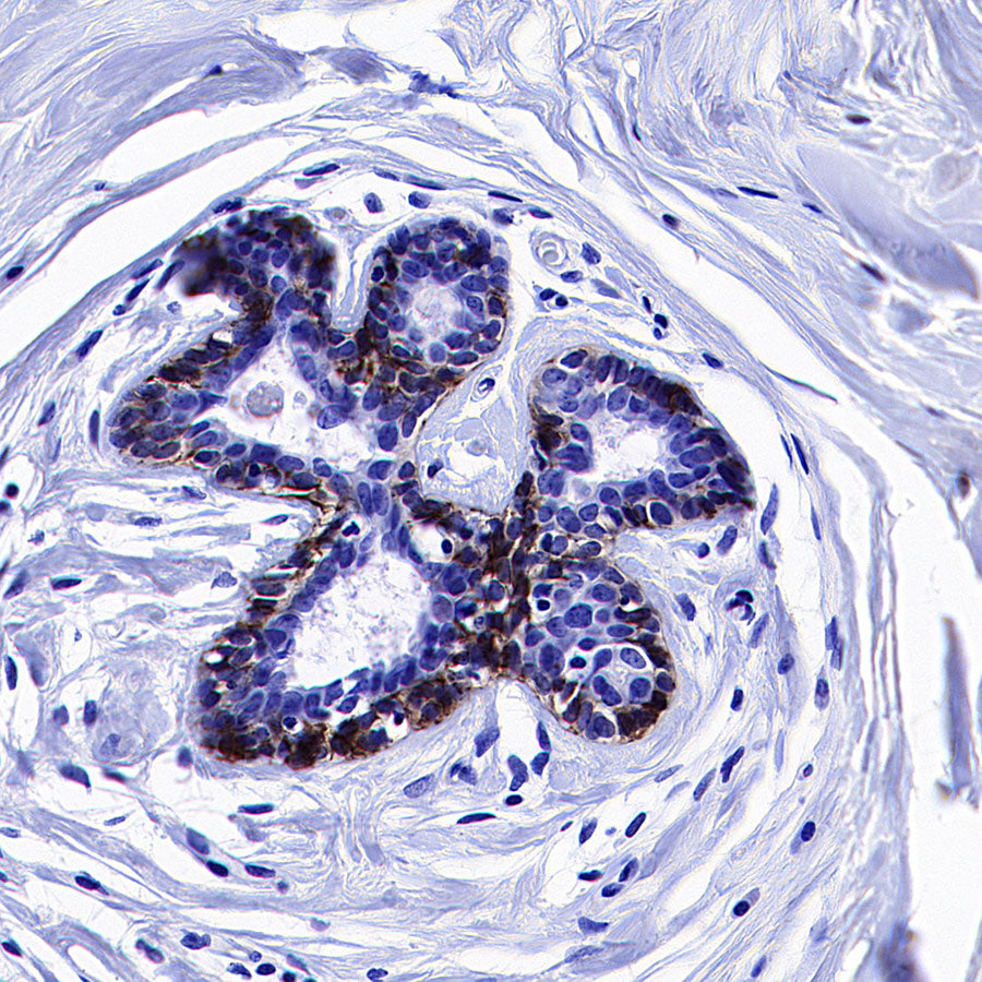 CDH3 Recombinant Rabbit mAb (S-3576-116)