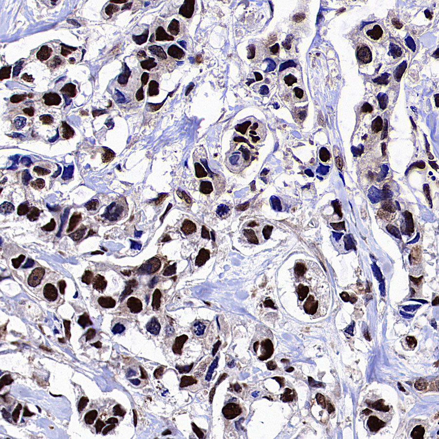 METTL1 Recombinant Rabbit mAb (S-4435-6)