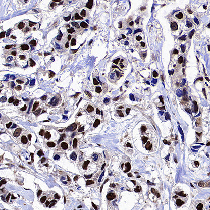 METTL1 Recombinant Rabbit mAb (S-4435-6)