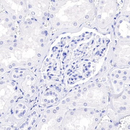 Estrogen Receptor α Recombinant Rabbit mAb (SDT-R371)