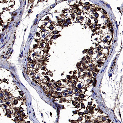 SOD2/MnSOD Rabbit Polyclonal Antibody