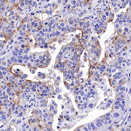CD133 Recombinant Rabbit mAb(SDT-1295-22)