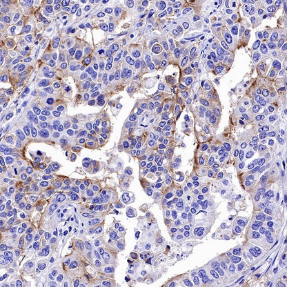 CD133 Recombinant Rabbit mAb(SDT-1295-22)