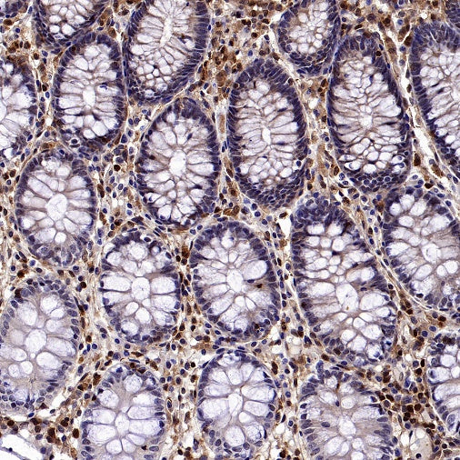 Stat5 Recombinant Rabbit mAb (S-2823-24)
