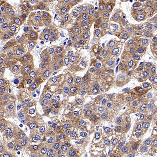 Acetyl-CoA Carboxylase Recombinant Rabbit mAb (S-2220-96)