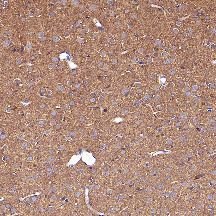 KLC1 Recombinant Rabbit mAb (S-4556-8)