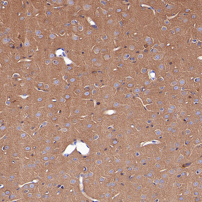 KLC1 Recombinant Rabbit mAb (S-4556-8)