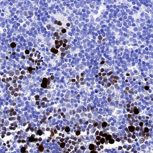 S-RMab® Ki67 Recombinant Rabbit mAb (SDT-R459)