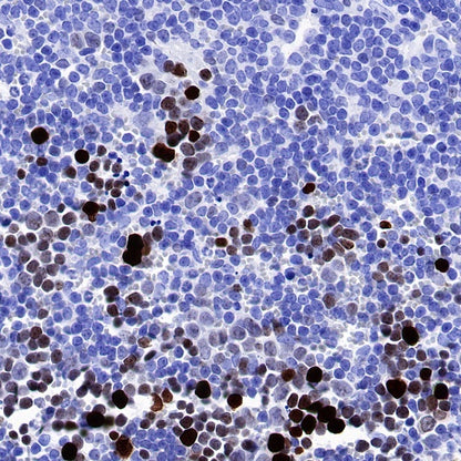 S-RMab® Ki67 Recombinant Rabbit mAb (SDT-R459)