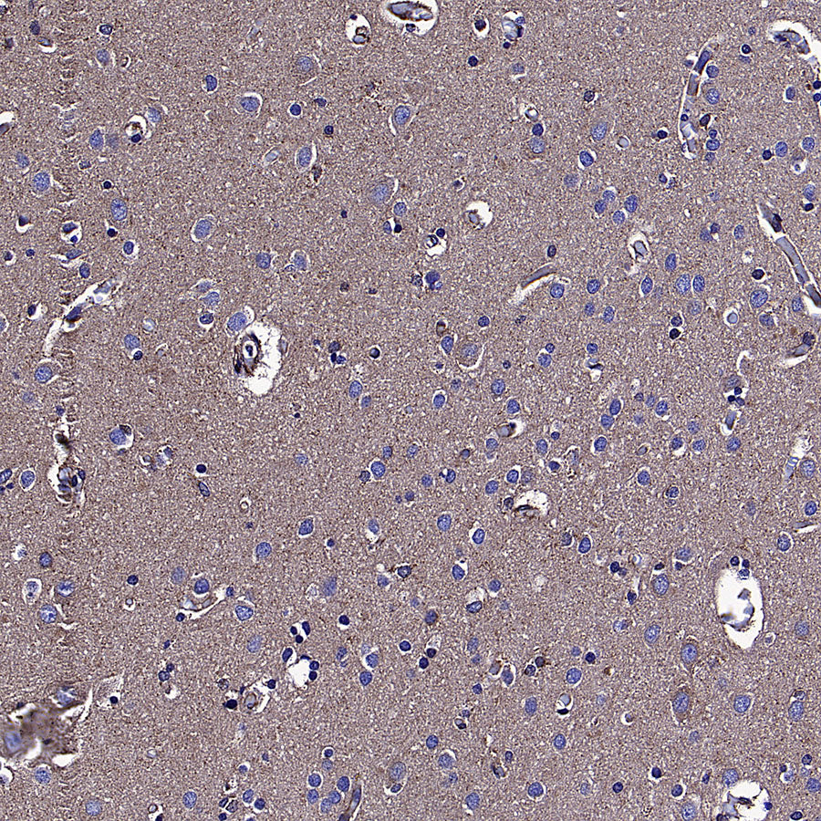 KLC1 Recombinant Rabbit mAb (S-4556-17)