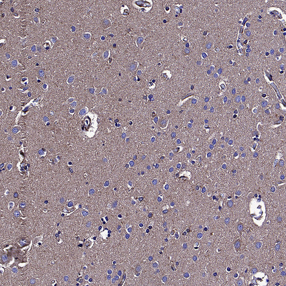 KLC1 Recombinant Rabbit mAb (S-4556-17)