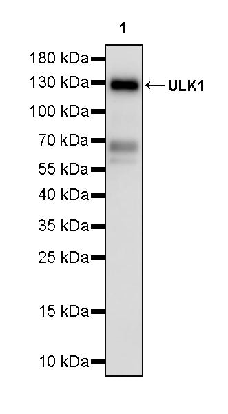 ULK1 Recombinant Rabbit mAb (S-5302)