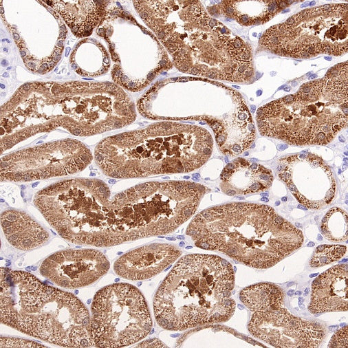 Prohibitin Recombinant Rabbit mAb (S-2679-7)